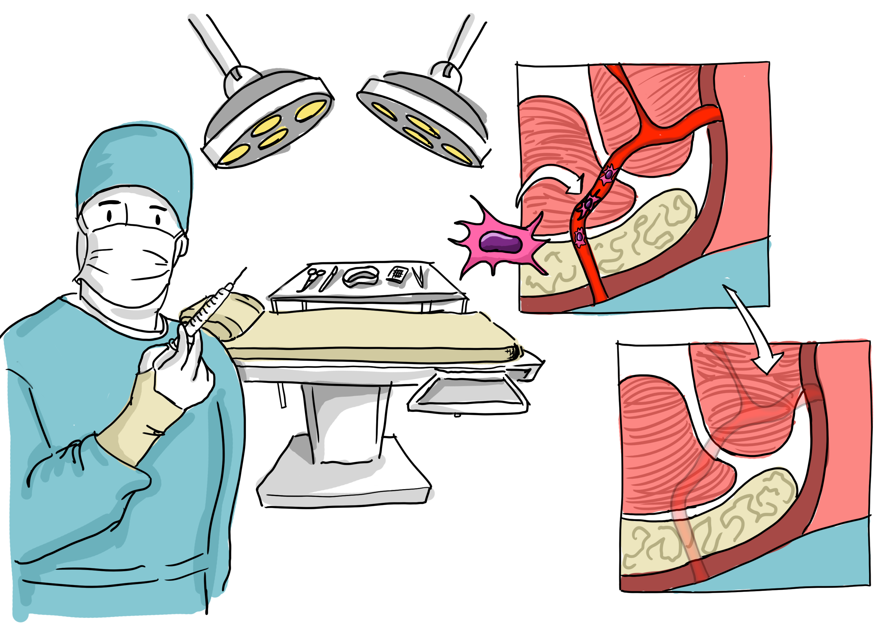 Top 10 Como Curar Una Fistula Sin Cirugia Abeamer 